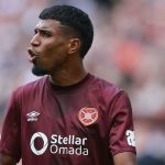 Gerald Taylor de Hearts : Une absence de longue durée à prévoir
