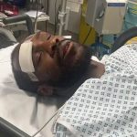 L-accident de Michail Antonio - un retour difficile pour le footballeur