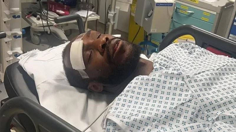 L-accident de Michail Antonio - un retour difficile pour le footballeur