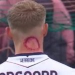 Un footballeur dément avoir été mordu par un zombie en Serie A