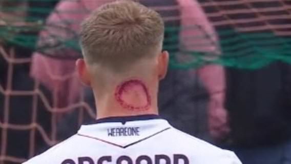 Un footballeur dément avoir été mordu par un zombie en Serie A