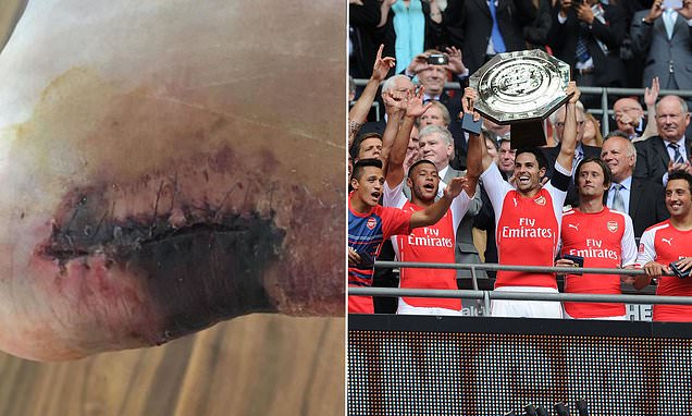 Blessure grave de Santi Cazorla au pied