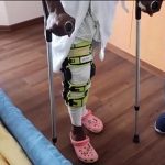 Alphonso Davies - sa grave blessure et son combat pour revenir