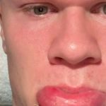 Erling Haaland blessé par une porte de bus : incident insolite en Norvège