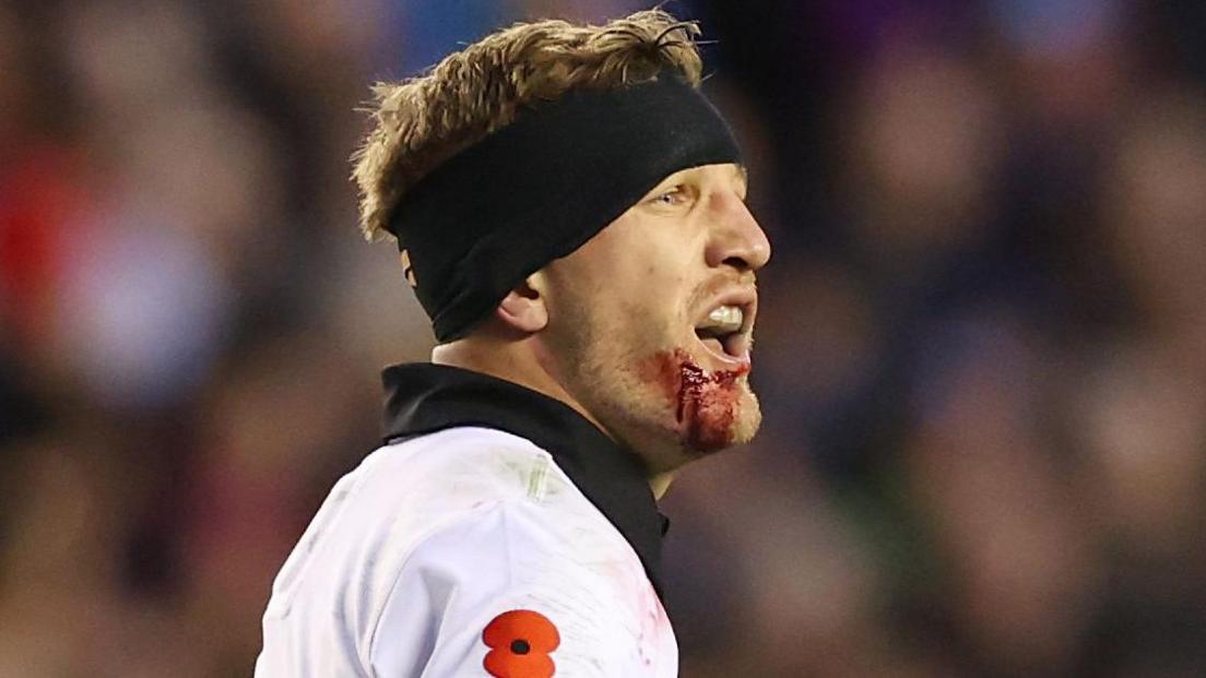 Damian McKenzie blessé au menton lors du match contre l’Écosse